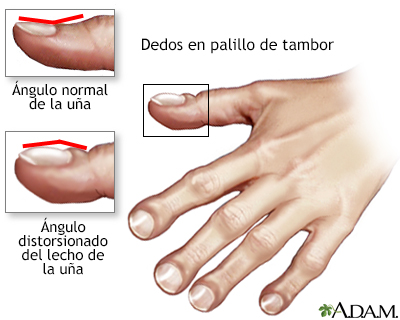 IMAGEN RECIEN NACIDO CUIDADO INTENSIVOS imagen recien nacido cuidado intensivos: