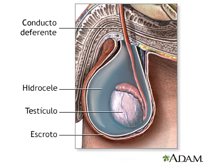 IMAGEN RECIEN NACIDO CUIDADO INTENSIVOS imagen recien nacido cuidado intensivos:
